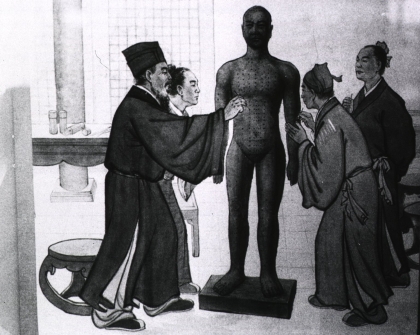 Historische Abbildung: Studenten üben Akupunktur an einem Modell