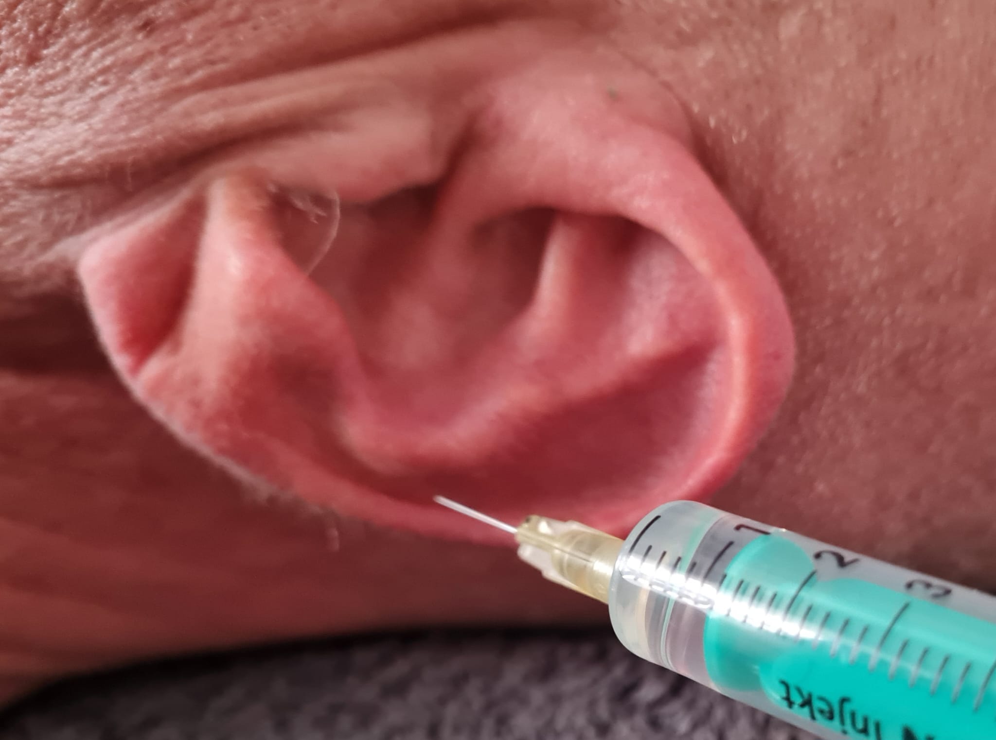 Symbolbild: Ohrregion als Injektionsareal